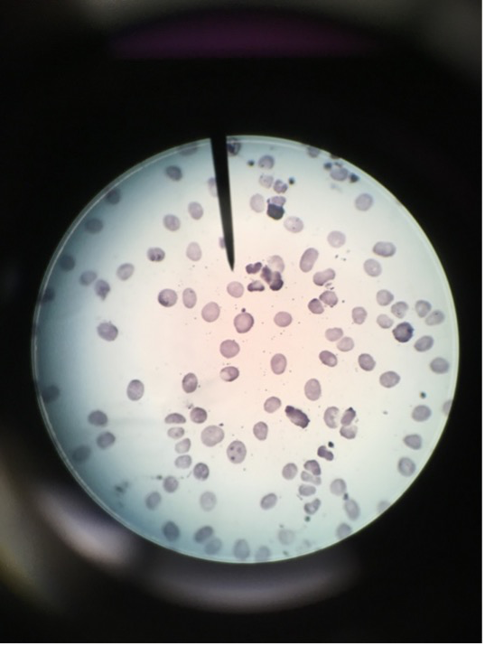 
							
								A microscope field with many cells visible. The cells are uniformly stained. 
							
							